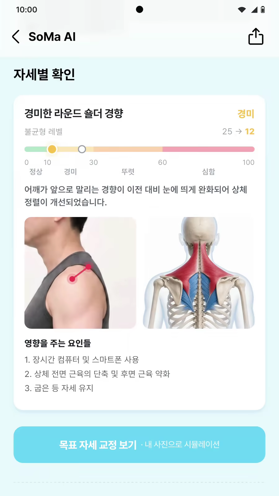 예시 화면 — 자세별 확인. 이전 기록과 지금 기록을 나란히 비교